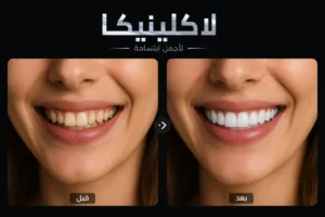 تجربتي مع تركيبات الزيركون في لاكلينيكا