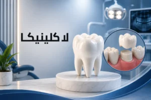 تركيب ضرس زيركون