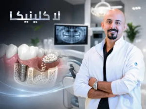 تجربتي مع زراعة عظم الفك