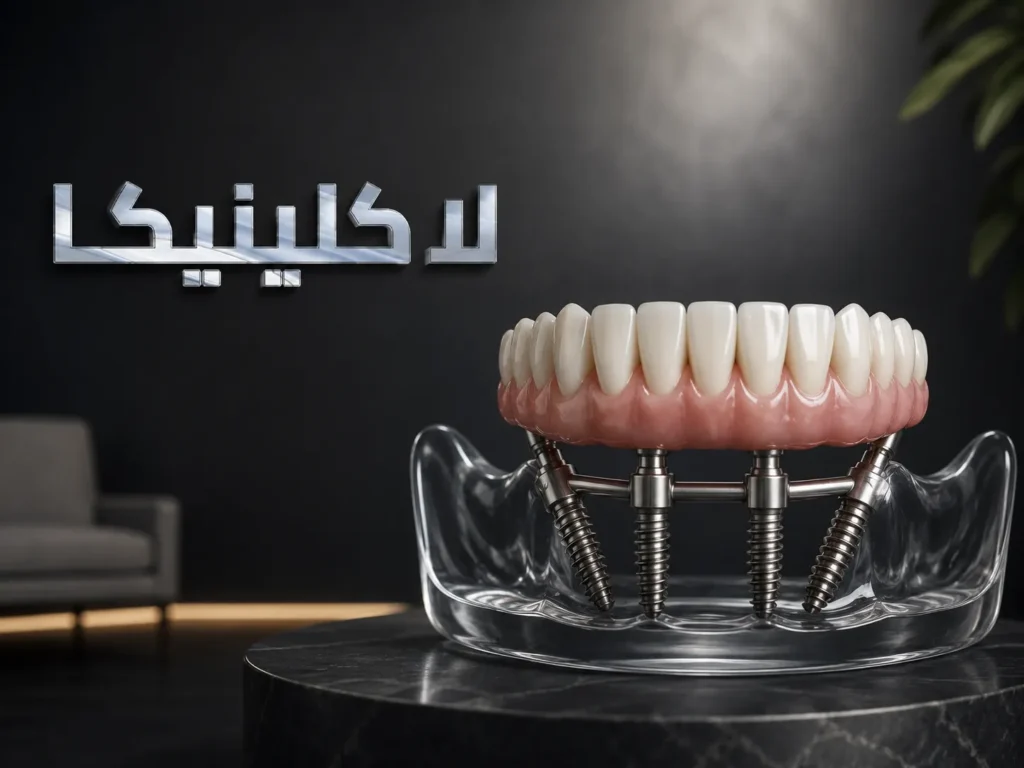 زراعة الأسنان all on 4 في الرياض: دليلك الشامل لاستعادة ابتسامتك في يوم واحد