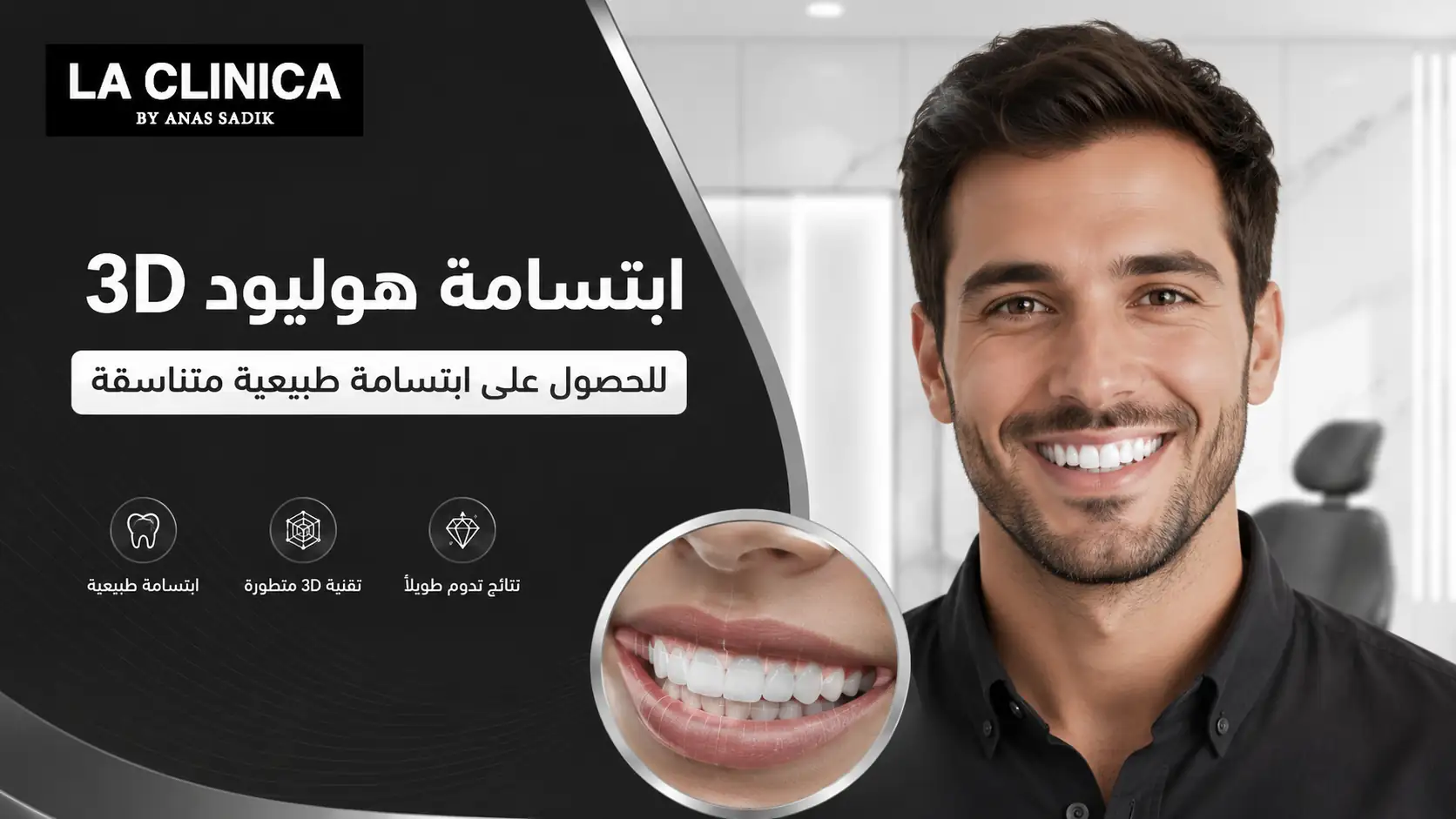 ابتسامة هوليود 3D للحصول على ابتسامة طبيعية متناسقة
