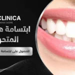 ابتسامة هوليود المتحركة للحصول على ابتسامة جميلة وطبيعية
