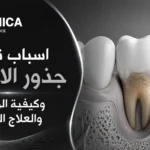 اسباب تاكل جذور الاسنان وكيفية الوقاية والعلاج المبكر
