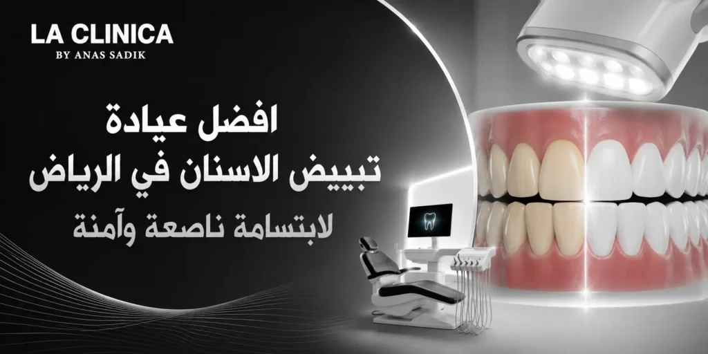 افضل عيادة تبييض الاسنان في الرياض