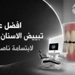 افضل عيادة تبييض الاسنان في الرياض لابتسامة ناصعة وآمنة