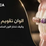 الوان تقويم الاسنان وكيف تختار اللون المناسب لشخصيتك
