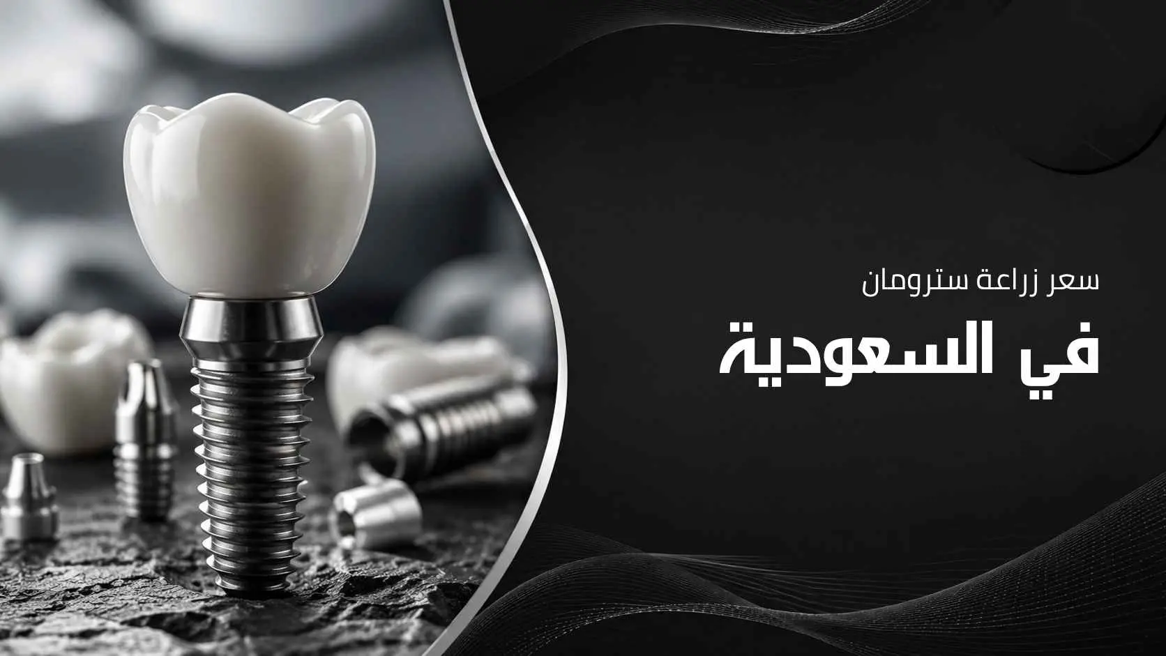 سعر زراعة سترومان في السعودية وأهم العوامل المؤثرة