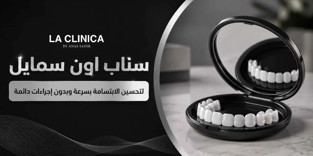 سناب اون سمايل لتحسين الابتسامة بسرعة وبدون إجراءات دائمة
