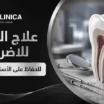 علاج الجذور للاضراس للحفاظ على الأسنان الطبيعية