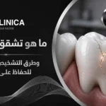 ما هو تشقق الاسنان وطرق التشخيص والعلاج للحفاظ على السن