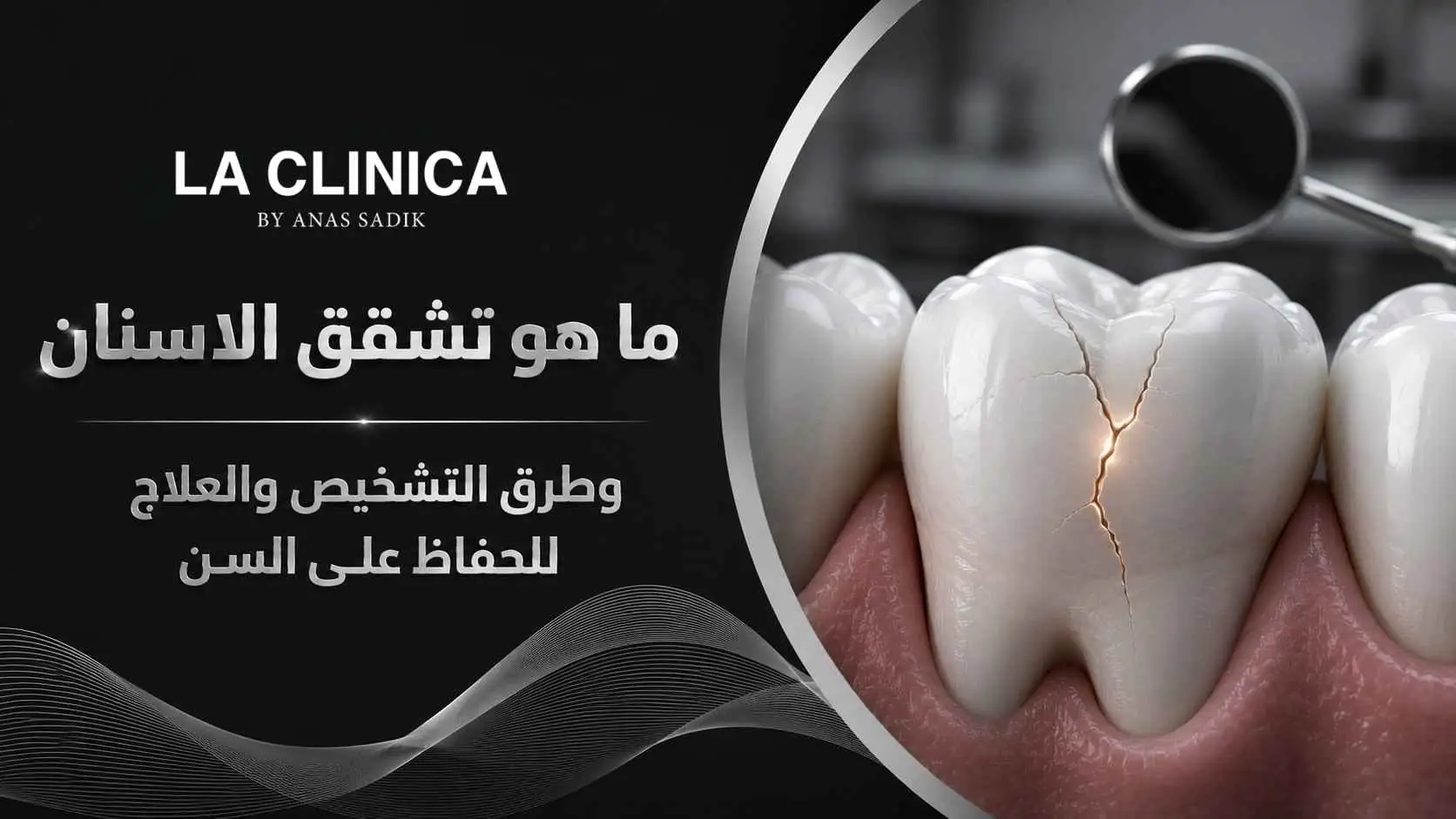 ما هو تشقق الاسنان وطرق التشخيص والعلاج للحفاظ على السن