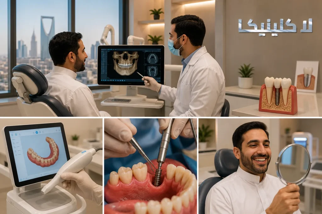ما هي مراحل زراعة الأسنان بالترتيب؟ دليلك الكامل من الفحص حتى الابتسامة النهائية