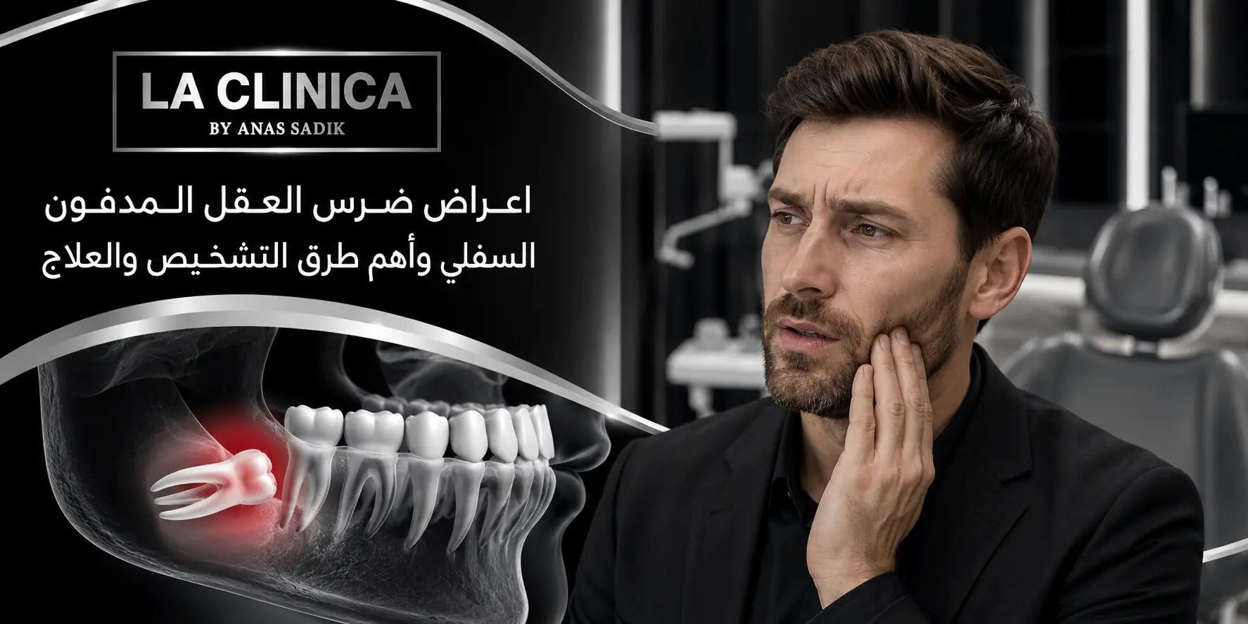 اعراض ضرس العقل المدفون السفلي وأهم طرق التشخيص والعلاج