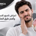 اعراض ناسور الاسنان الخطيرة وأهم طرق العلاج الفعالة