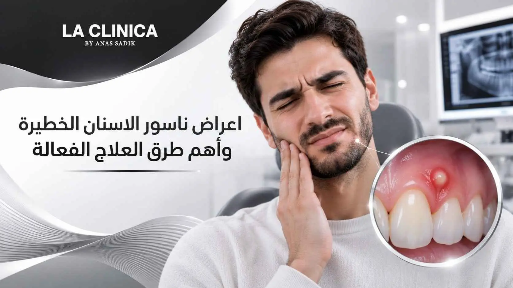 اعراض ناسور الاسنان الخطيرة وأهم طرق العلاج الفعالة