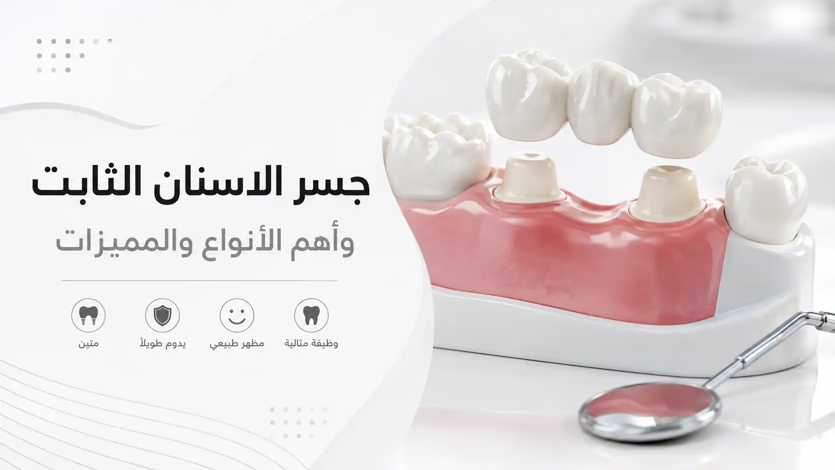 جسر الاسنان الثابت وأهم الأنواع والمميزات