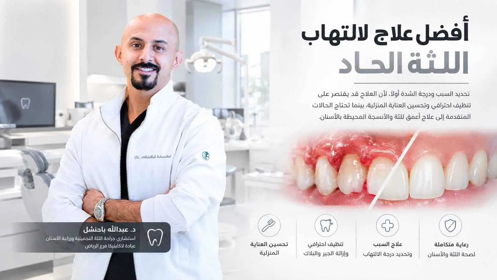 افضل علاج لالتهاب اللثة الحاد