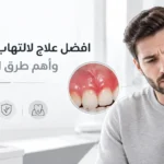 افضل علاج لالتهاب اللثة الحاد وأهم طرق العلاج