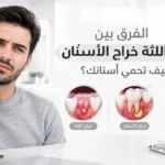 الفرق بين خراج اللثة خراج الأسنان وكيف تحمي أسنانك؟