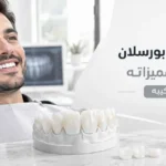 تركيب اسنان بورسلان وأنواعه ومميزاته وخطوات تركيبه