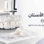تركيبات الأسنان emax ومميزاتها وأنواعها واستخداماتها