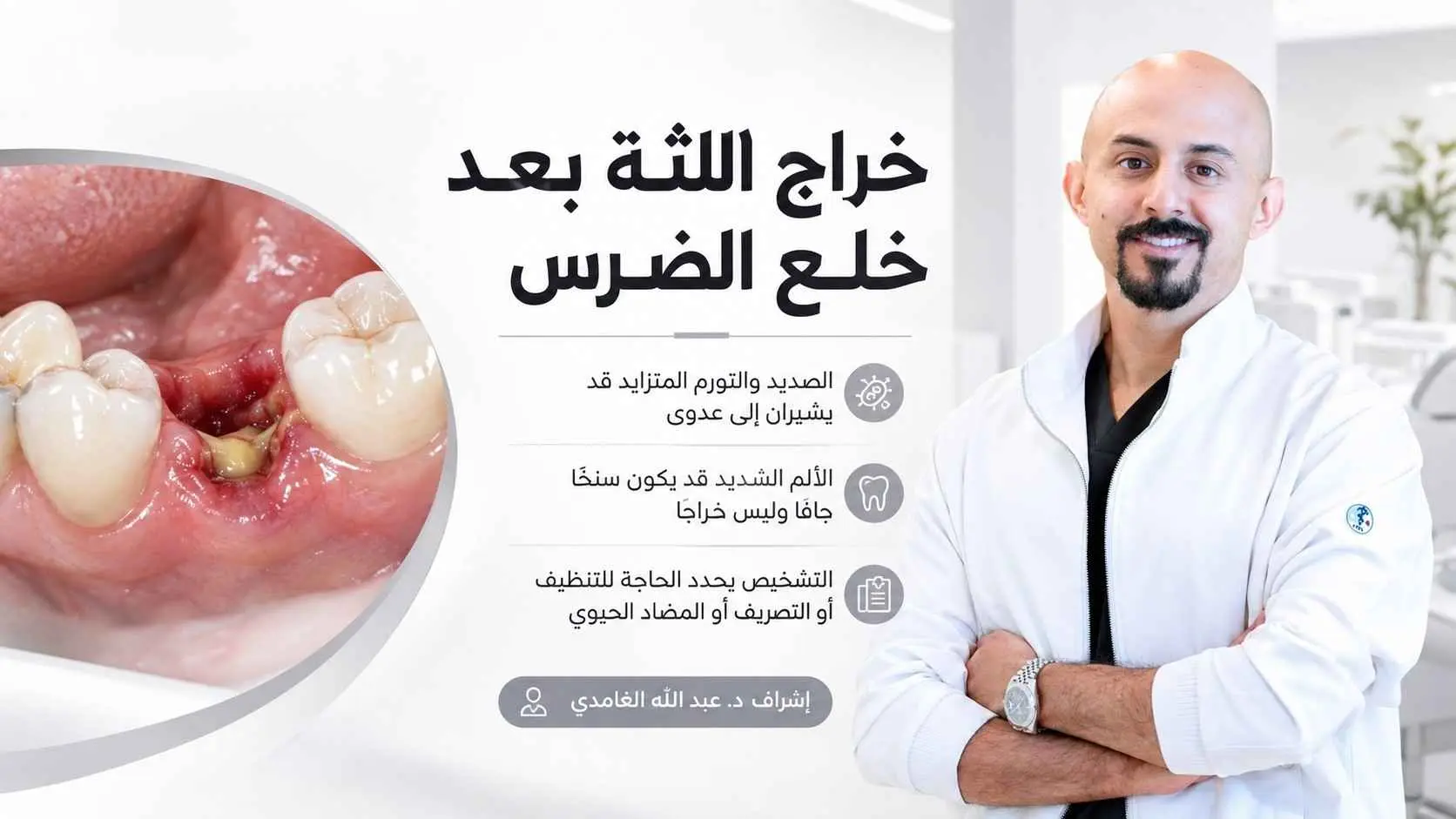 خراج اللثة بعد خلع الضرس