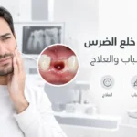 خراج اللثة بعد خلع الضرس الأعراض والأسباب والعلاج