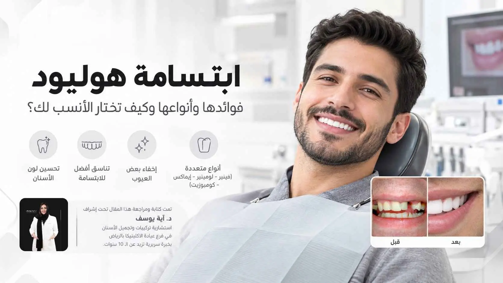 فوائد ابتسامة هوليود