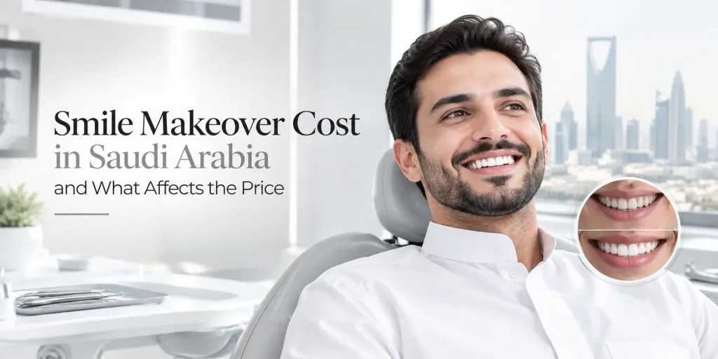 smile makeover cost