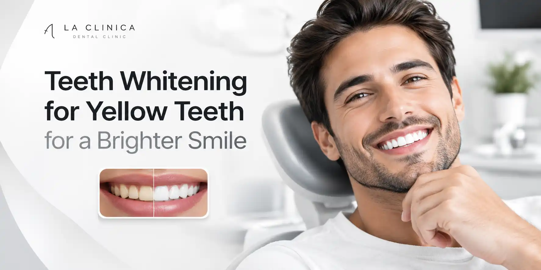 teeth whitening for yellow teeth