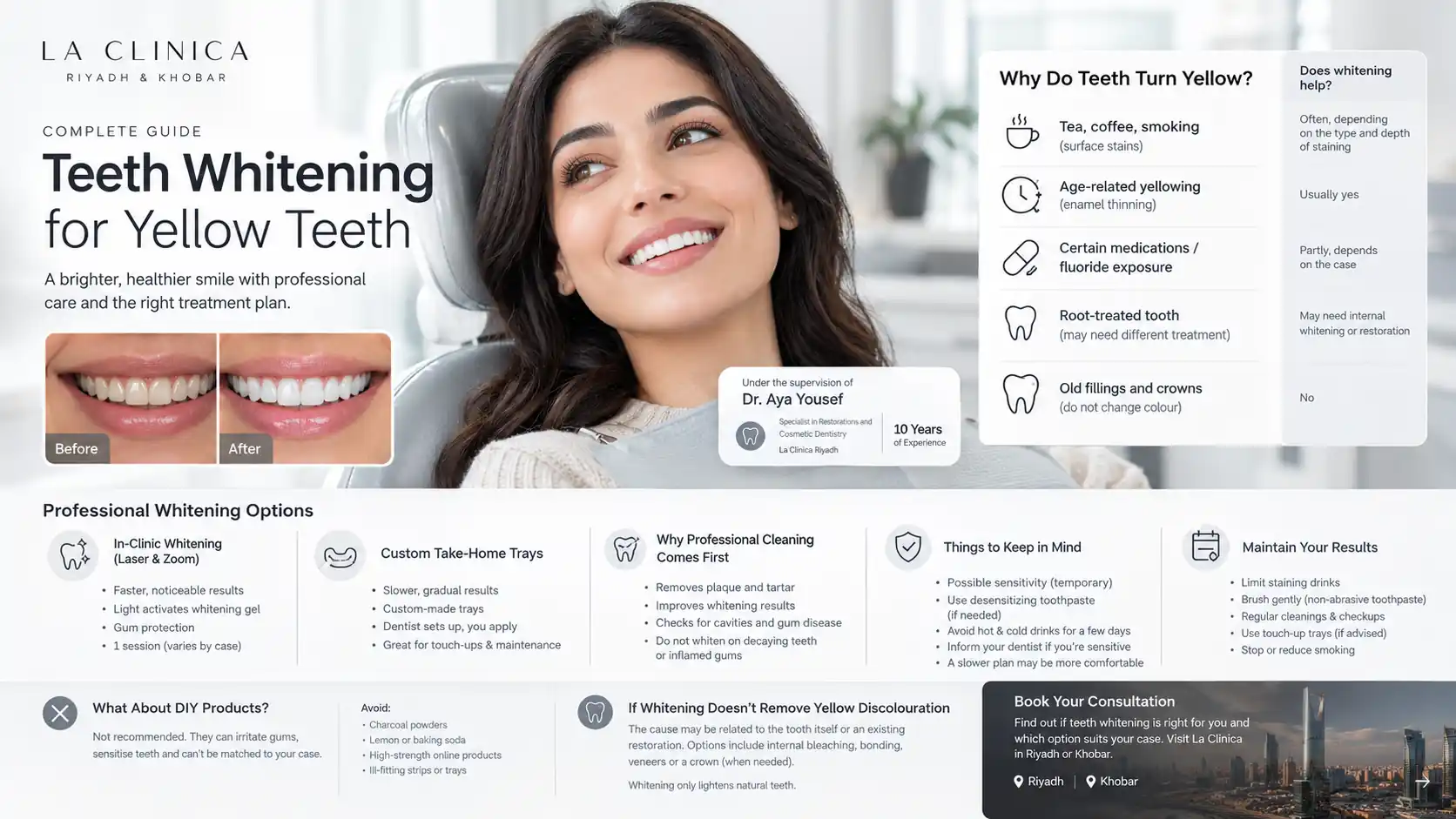 teeth whitening for yellow teeth