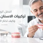 افضل انواع تركيبات الاسنان المتحركة وكيف تختار الأنسب