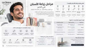 زراعة الاسنان في الخبر