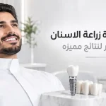 افضل عيادة زراعة الاسنان في الخبر لنتائج مميزه